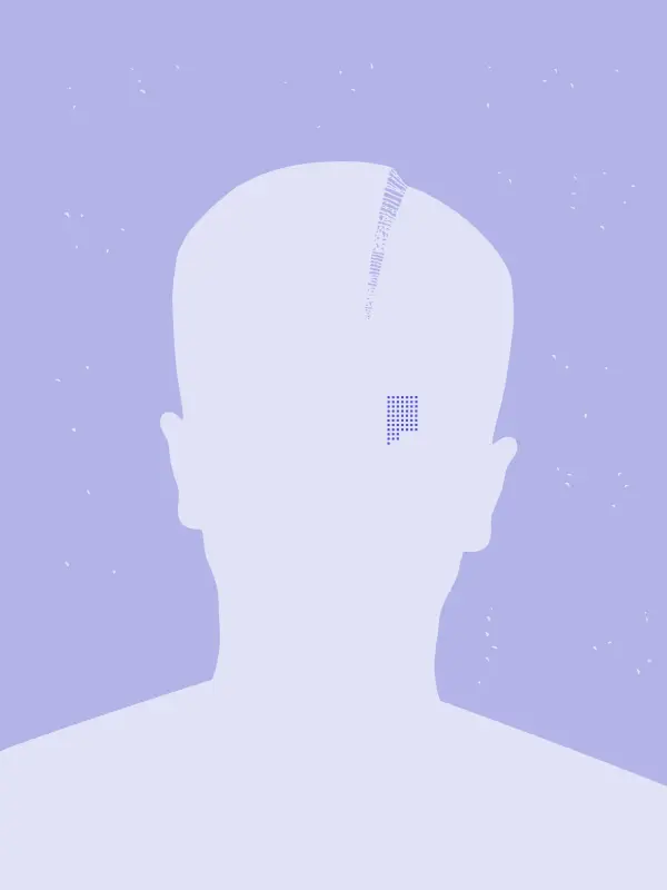 Glitched Avatar with missing pixels