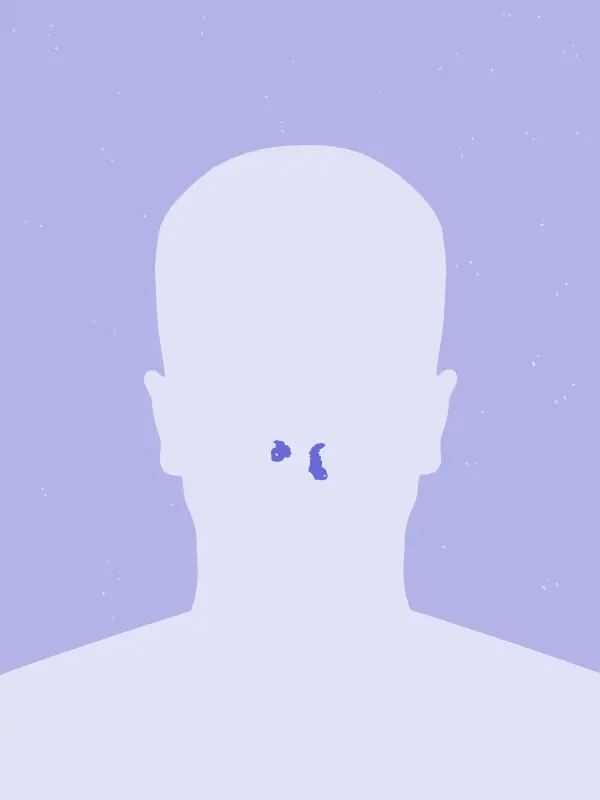 Avatar with a bleeding nose